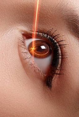 Kapan Operasi LASIK Menjadi Pilihan Tepat? Kenali Kondisi Mata yang Perlu Diperhatikan