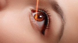 Ilustrasi prosedur operasi LASIK menggunakan teknologi laser untuk memperbaiki kelainan refraksi pada mata, sehingga membantu meningkatkan kualitas penglihatan dan mengurangi ketergantungan terhadap kacamata maupun lensa kontak.